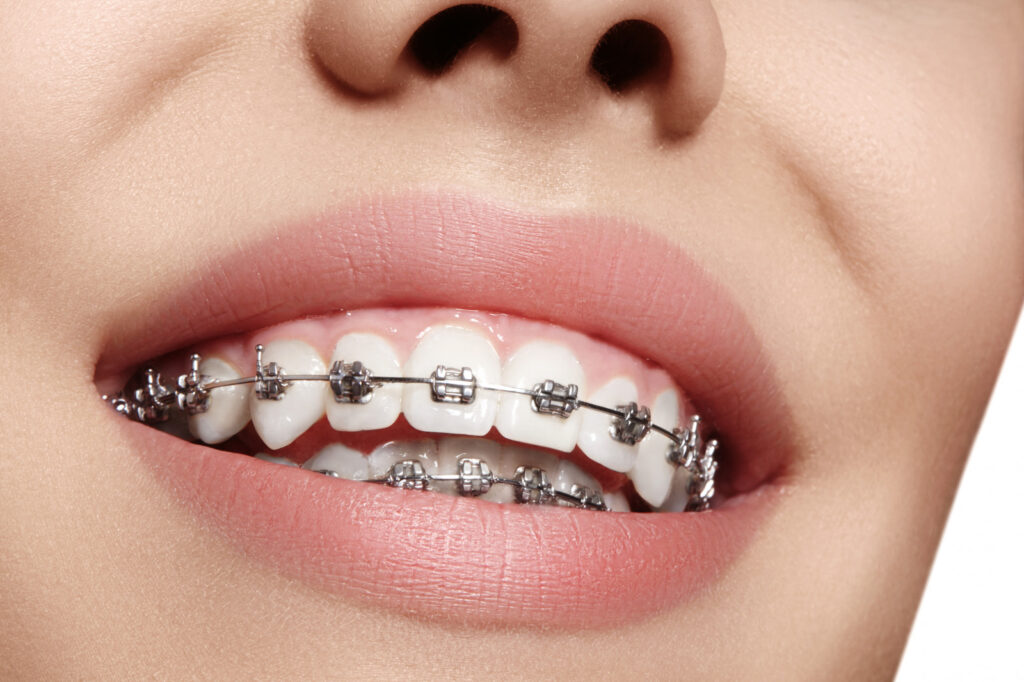 orthodontist in garvey 
